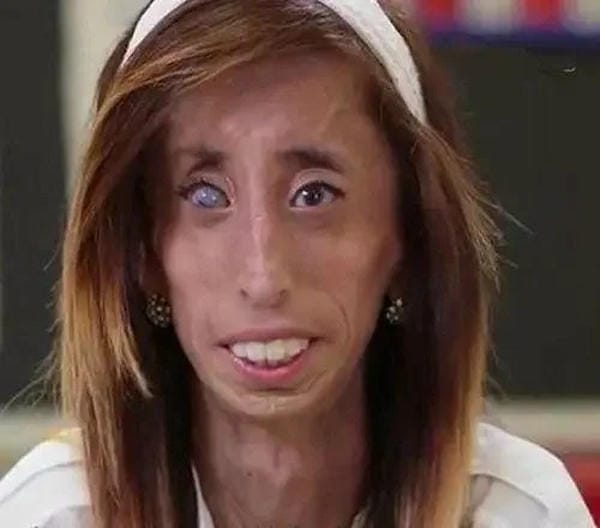 ảnh gái xấu (2) ảnh gái xấu (2)